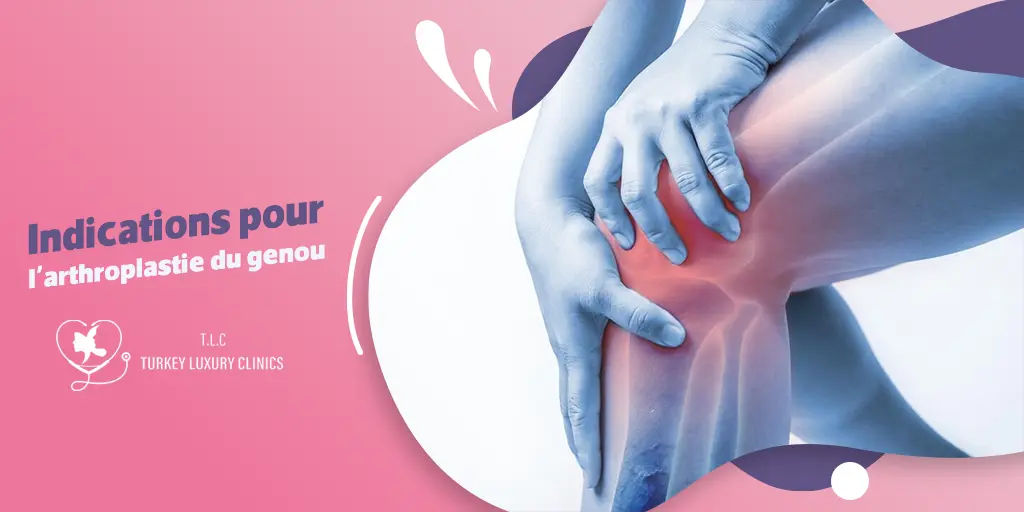 Indications pour l'arthroplastie du genou