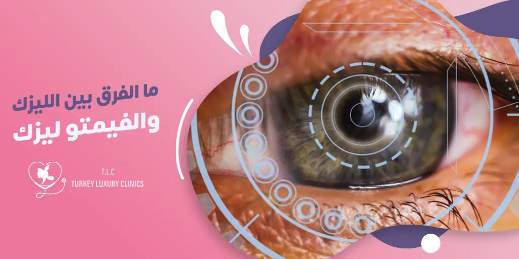 ما الفرق بين الليزك والفيمتو ليزك؟