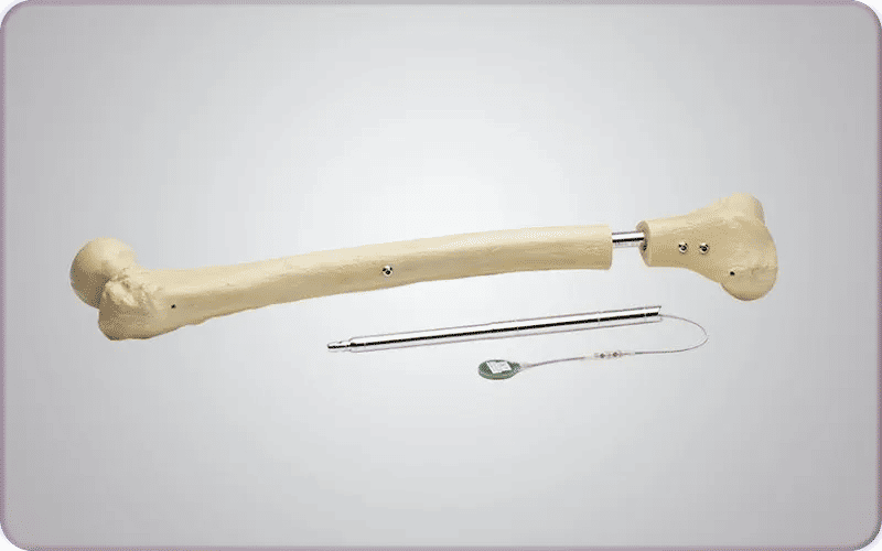 What Is Fitbone Orthofix?