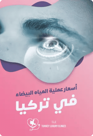 أسعار عملية المياه البيضاء في تركياfeatured image
