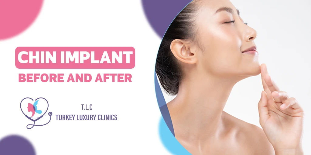 Chin Implant Before and After: Real Photos & Results 2026
