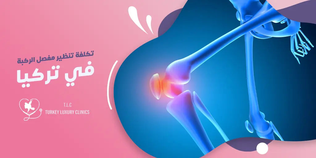 تكلفة تنظير مفصل الركبة في تركيا
