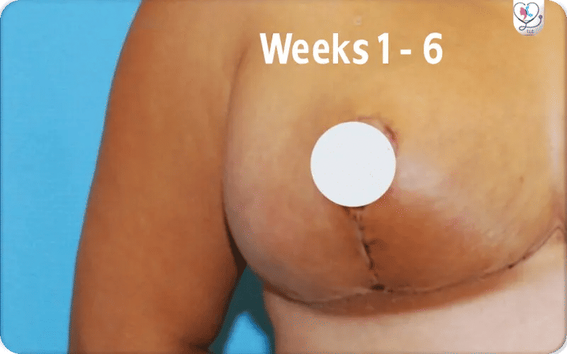 Early Stages (Weeks 1   6)