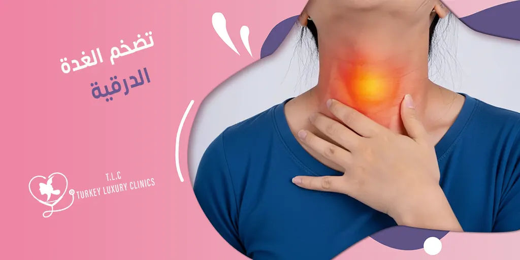 تضخم الغدة الدرقية: التشخيص والأنواع والأسباب والوقاية