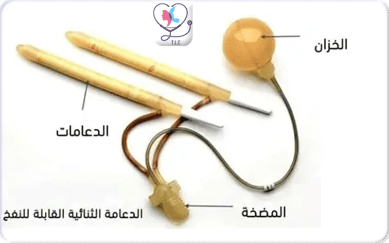 أنواع الدعامة الهيدروليكية