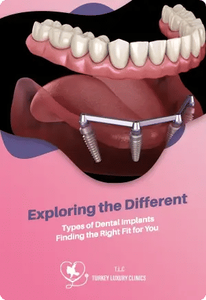 Exploring the Different Types of Dental Implants: Finding the Right Fit for You