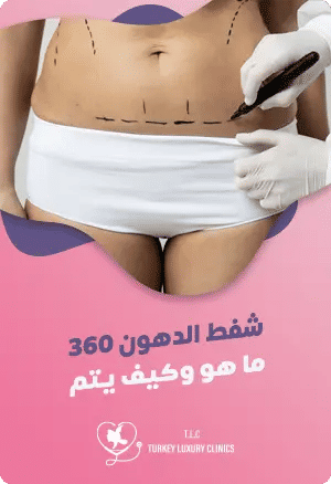 شفط الدهون 360 درجة: ما هو وكيف يتم؟featured image