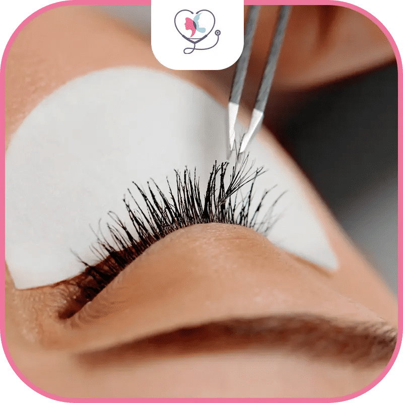 candidats-à-la-greffe-de-cils