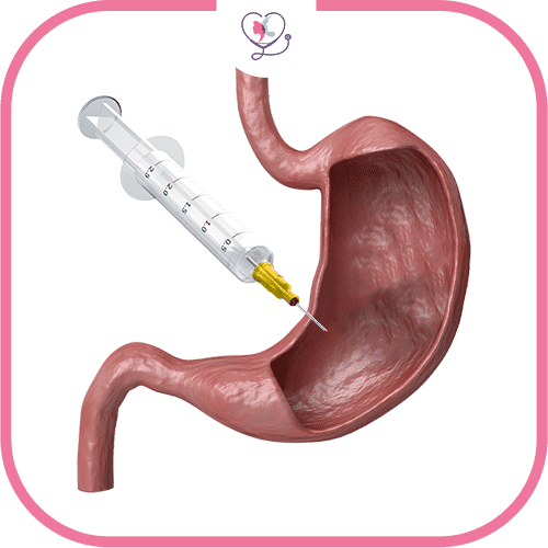 الفرق بين تكميم المعدة وبوتكس المعدة من حيث خطوات العملية-2