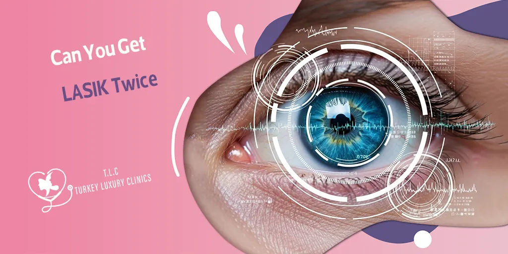 ¿Se puede hacer LASIK dos veces? Seguridad y resultados