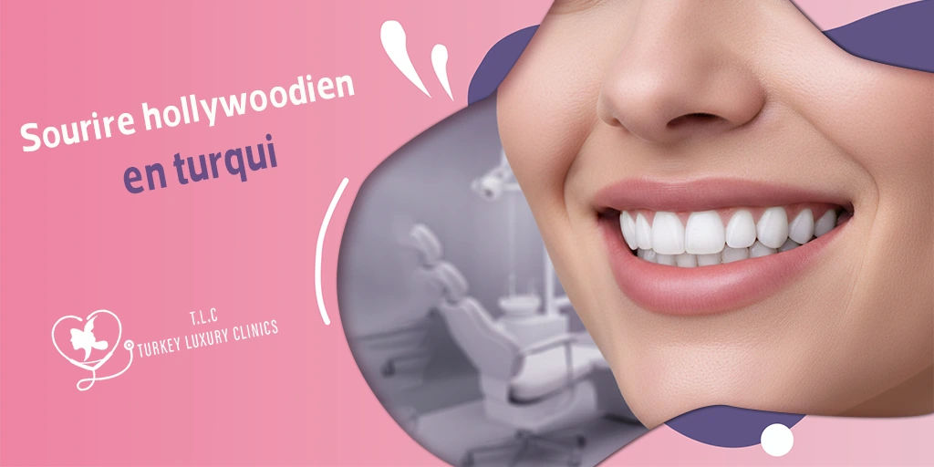 Sourire hollywoodien en turqui : prix, techniques, conseils et risques