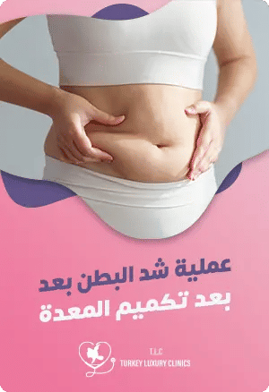 عملية شد البطن بعد تكميم المعدةfeatured image