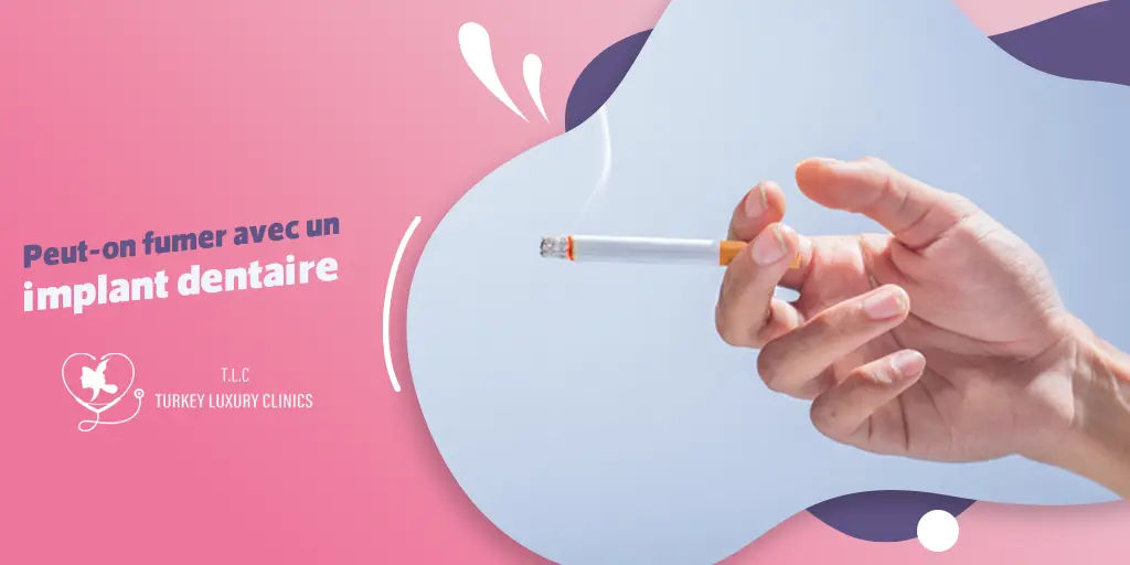 Peut-on fumer avec un implant dentaire