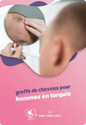 Greffe de cheveux pour hommes en Turquie