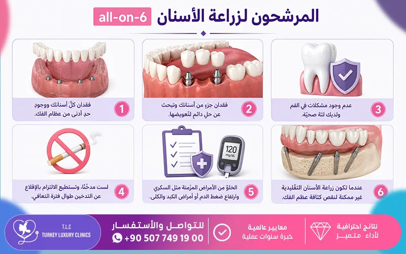 المرشحون لزراعة الأسنان all-on-6