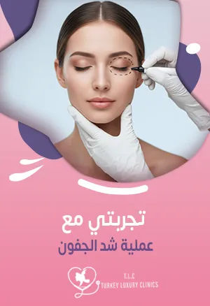 تجربتي مع عملية شد الجفون: النتائج بالصور والفيديوfeatured image