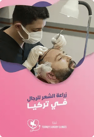 زراعة الشعر للرجال في تركيا: التقنيات والنتائج مع التكلفةfeatured image