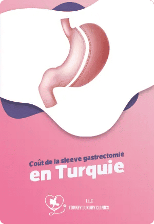 Coût de la sleeve gastrectomie en Turquiefeatured image