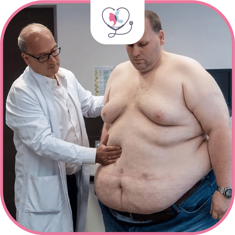 suis-je un bon candidat pour la sleeve gastrectomie