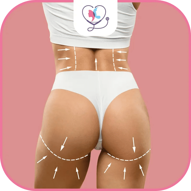 ما هي عملية تكبير المؤخرة البرازيلية؟