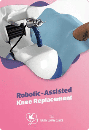 Robotergestützte Knieendoprothese