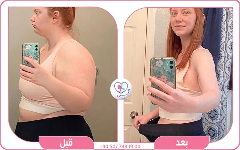 ماهي أضرار عملية تحويل المسار؟