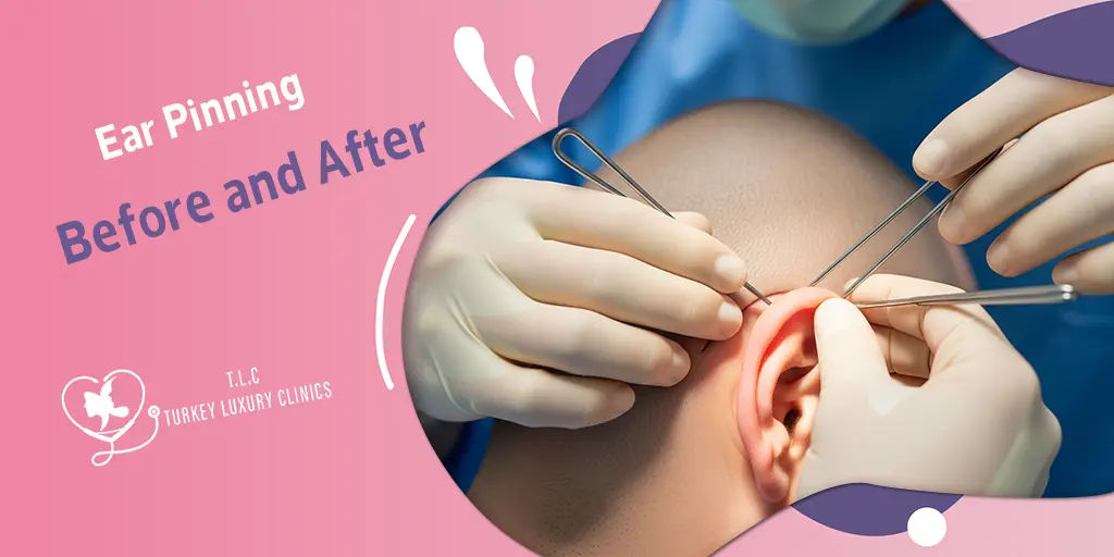 Ear Pinning Before and After: Otoplasty Results & Recovery Real Photos