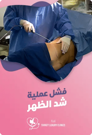  فشل عملية شد الظهرfeatured image