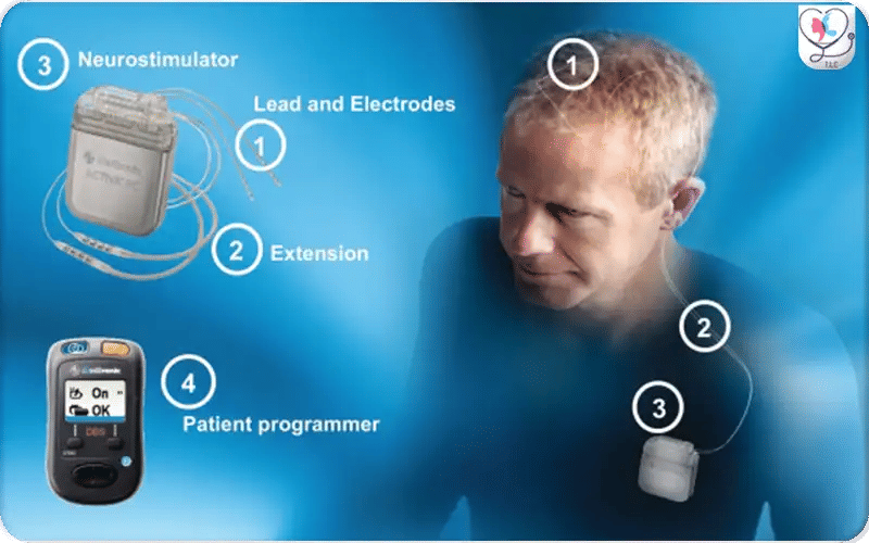 5. Programming and Activation