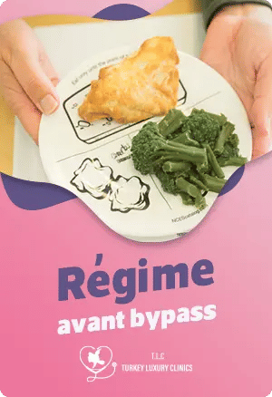 Régime avant bypass : Conseils pour une préparation réussie