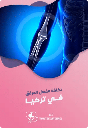 تكلفة استبدال مفصل المرفق في تركياfeatured image