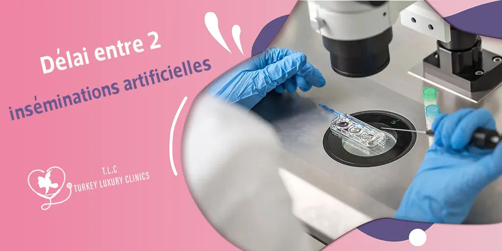 Délai entre 2 inséminations artificielles : combien de temps faut-il attendre ?
