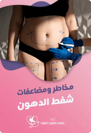 أضرار عملية شفط الدهونfeatured image