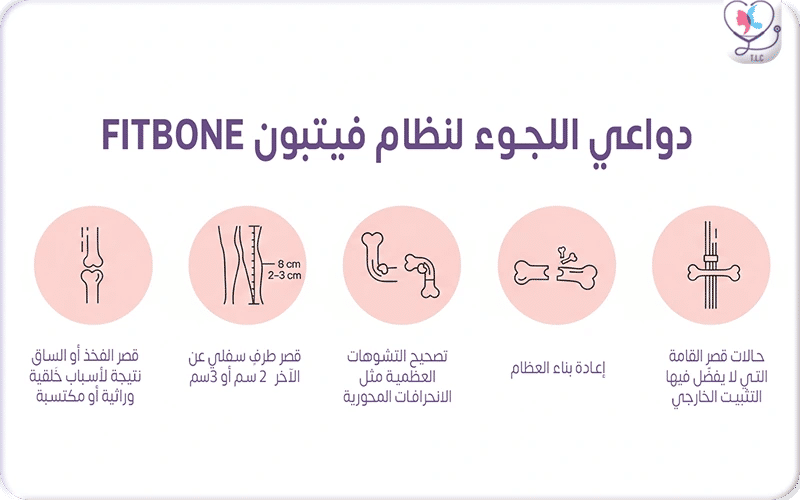 دواعي اللجوء لنظام فيتبون FITBONE