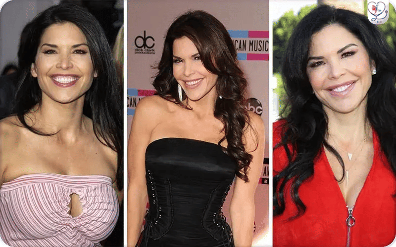 What Plastic Surgery Has Lauren Sanchez Had?