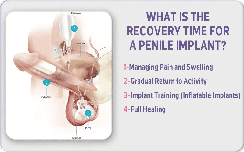 What is the Recovery Time for a Penile Implant?