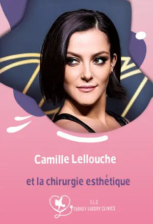 Camille Lellouche et la chirurgie esthétique : vérité, rumeurs et avant/aprèsfeatured image
