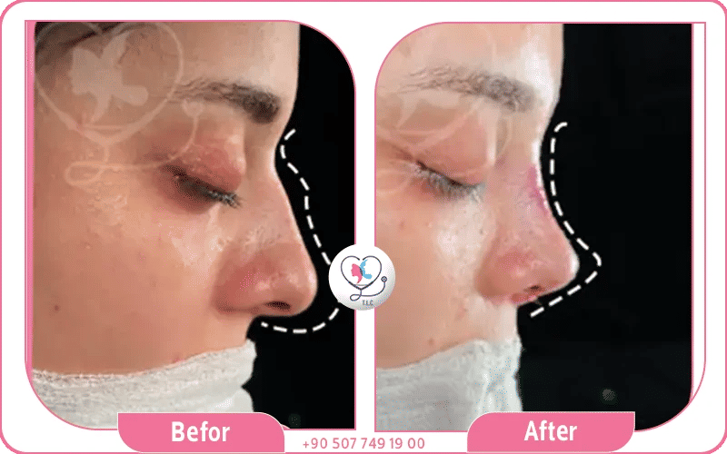 1. خبرة الطبيب والشهادات الحاصل عليها