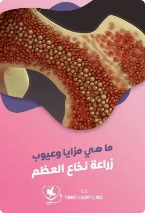 ما هي مزايا وعيوب زراعة نخاع العظم؟featured image