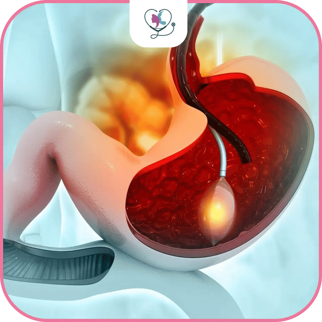 الكبسولة الذكية في تركيا