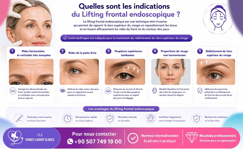 Quelles sont les indications du Lifting frontal endoscopique?