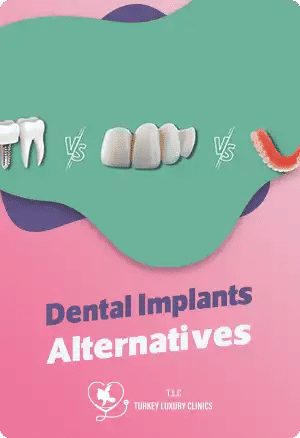 Dental Implant Alternatives: Bridges, Dentures & More