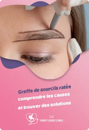 Greffe de sourcils ratée : comprendre les causes et trouver des solutions