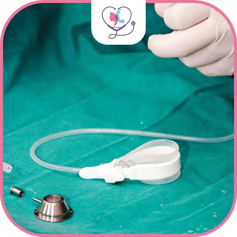 لماذا تختار تركيا لإجراء عملية ربط المعدة؟