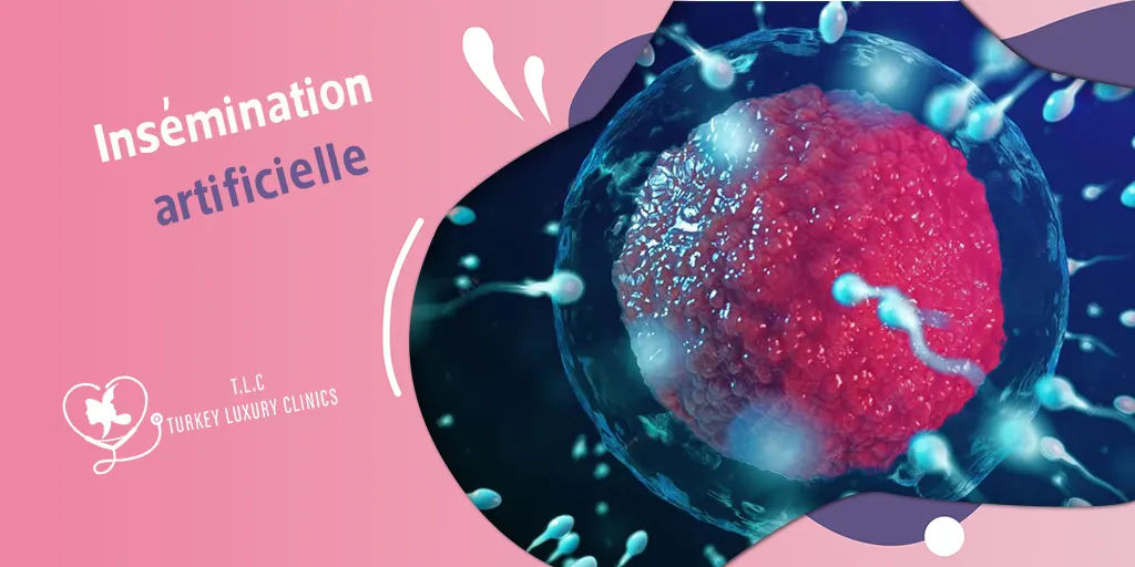 Insémination artificielle : avantages, limites et chances de réussite