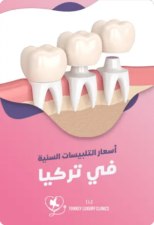 أسعار تلبيس الأسنان في تركياfeatured image