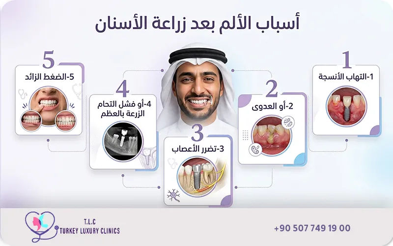 أسباب الألم بعد زراعة الأسنان