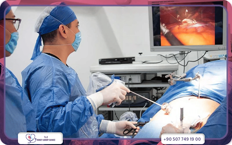 Who Performs Gastric Sleeve Surgery?