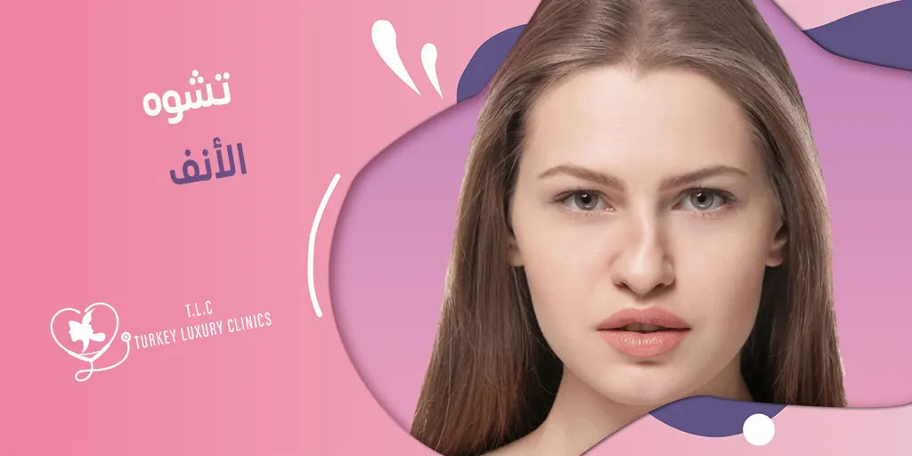 تشوه الأنف: أسبابه وخيارات التجميل المتاحة
