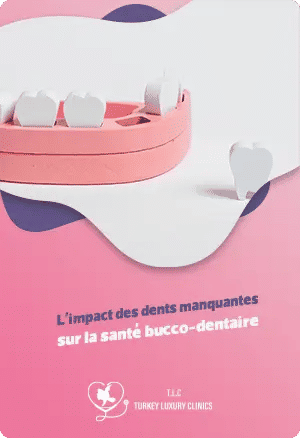 L'impact des dents manquantes sur la santé bucco-dentairefeatured image